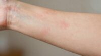 distinguishing soreness from injury