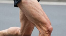 hip flexor pain worsens activity